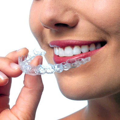 Invisalign Braces in Roseville, CA