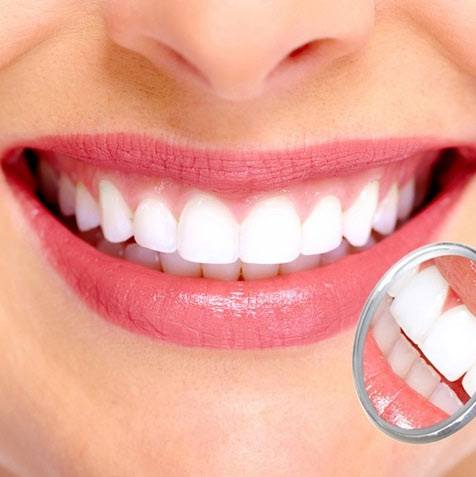 Teeth Whitening in Roseville, CA